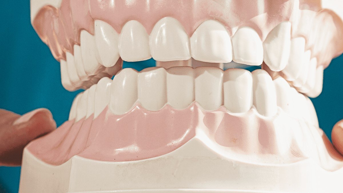 A dental model used to explain teeth whitening A dentist holding a dental model used to explain teeth whitening in Orlando