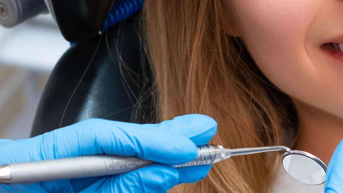 A cosmetic bonding procedure in Orlando A dentist shaping tooth-colored bonding resin on a patient's front tooth in Orlando