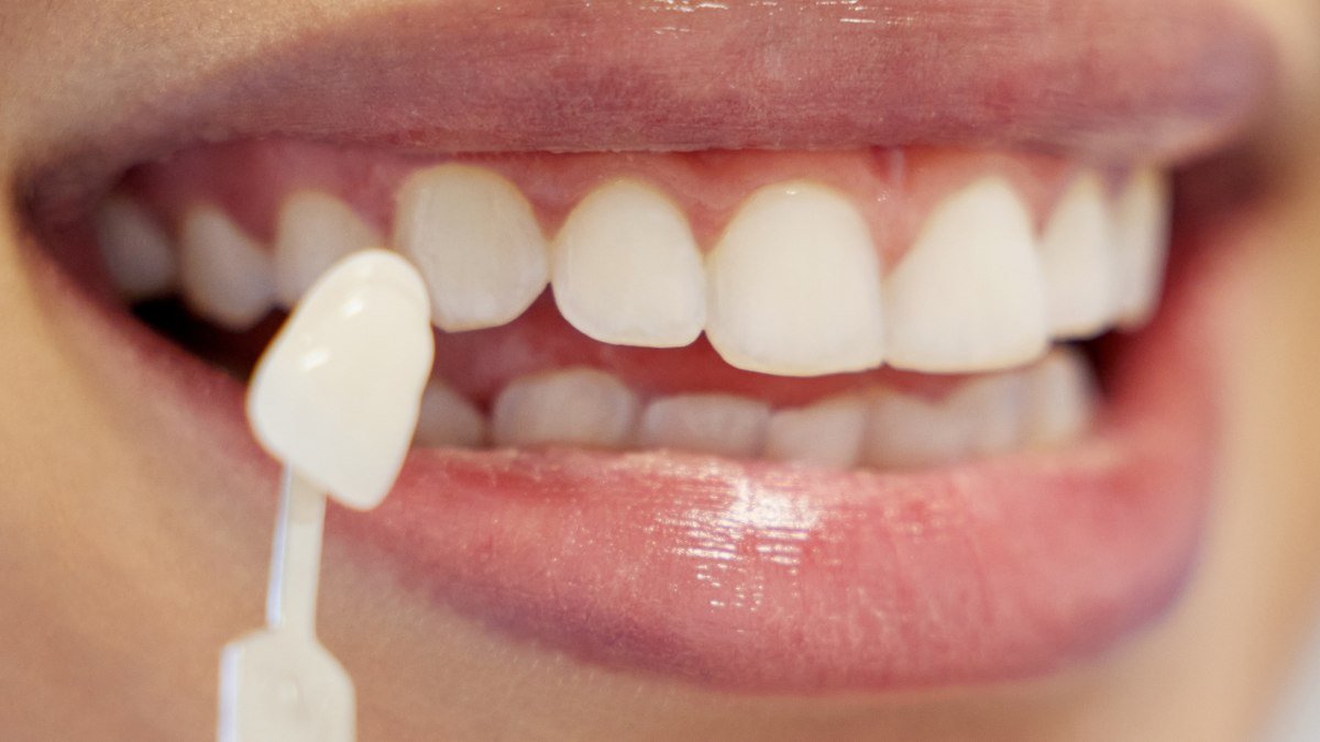 A restorative dental consultation in Orlando A dentist reviewing a patient's smile during a restorative crown consultation in Orlando