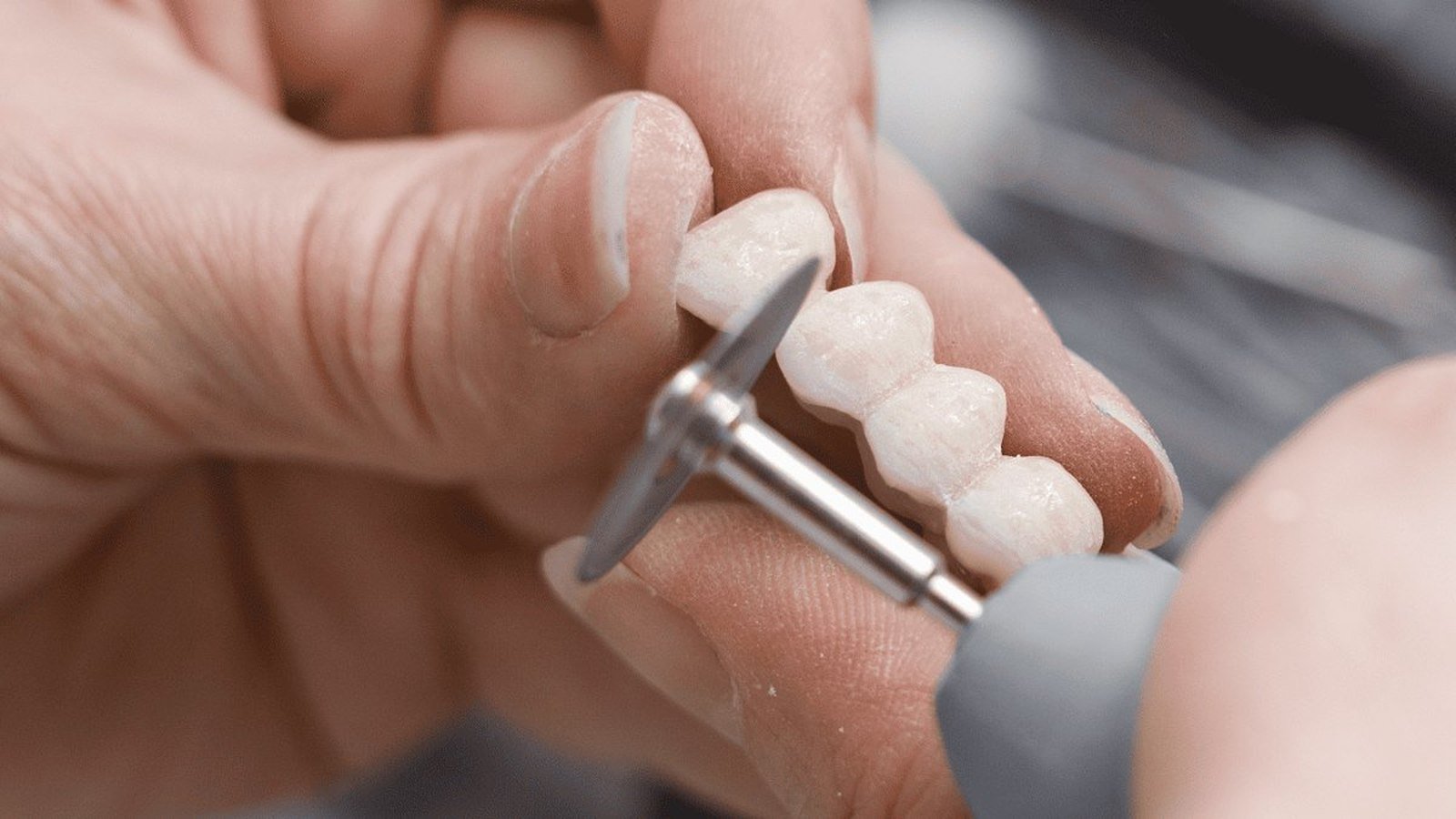 A dental technician finishing a multi-unit fixed dental bridge