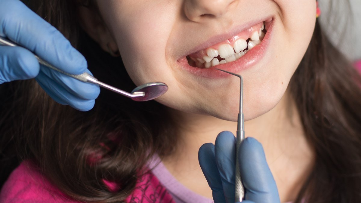 A child at a preventive dental sealant visit in Orlando Child smiling in a dental chair during a preventive dental sealant visit in Orlando