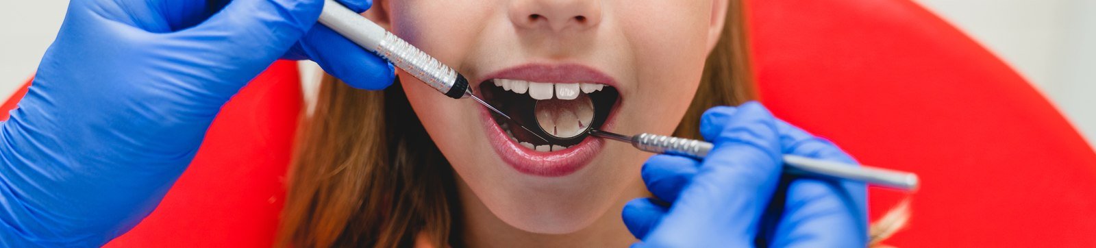 A dentist examining a child's back teeth during a preventive dental visit in Orlando
