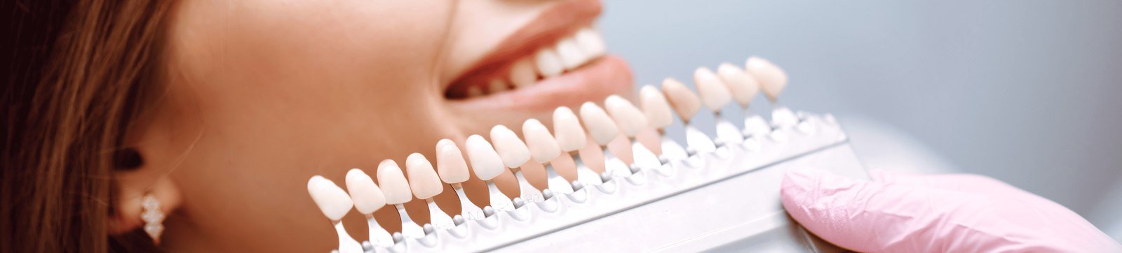 Dental professional comparing porcelain veneer shade options against a patient's smile in Orlando