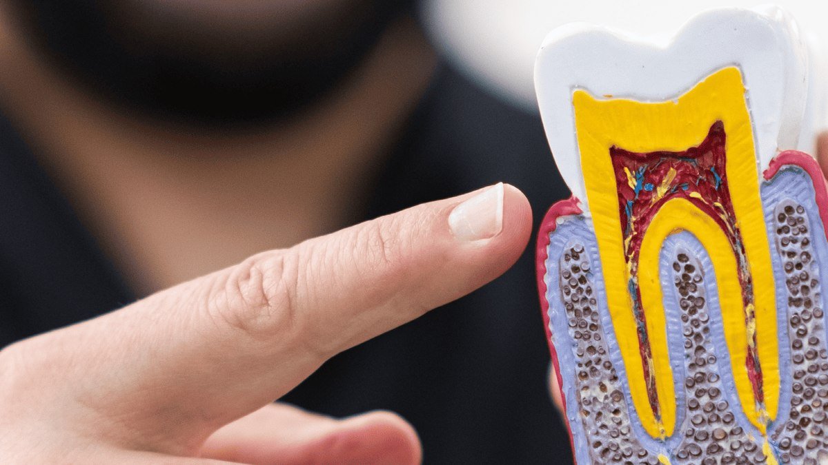 A dental probe pointing to decay reaching the pulp on a cross-section tooth model
