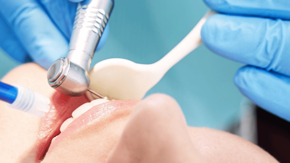 A calm, monitored sedation dentistry visit A patient receiving treatment calmly during a monitored sedation dentistry visit