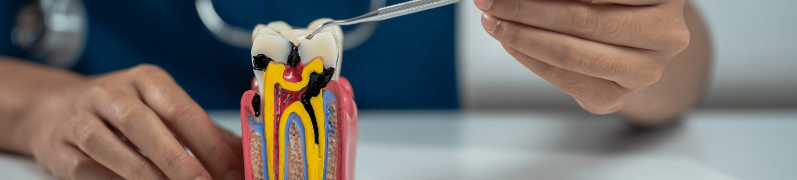 A dentist holding a cross-section tooth model showing the inner nerve and pulp