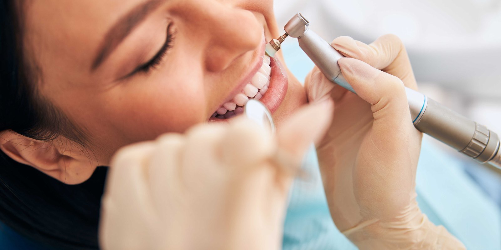 Dental hygienist performing a professional teeth cleaning on a patient at an Orlando dental office